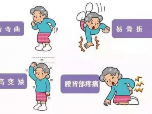 健康生活方式月 | 打好这套组合拳，有效预防骨质疏松